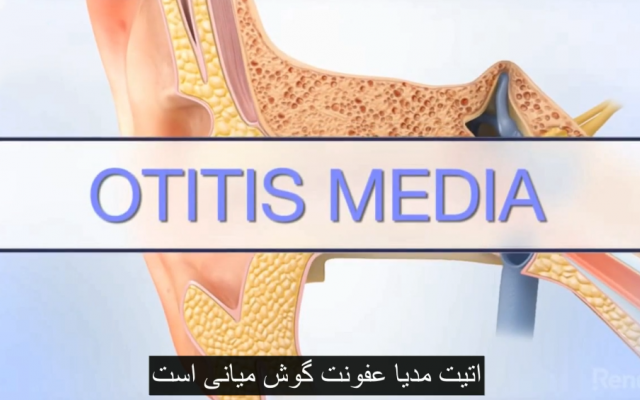 ویدیوی شما رو هاردساب کنم