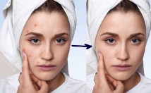 عکسهاتون-ادیت-روتوش